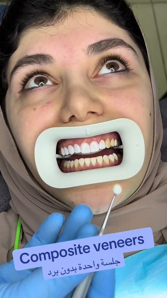 TikTok video thumbnail by clinics2020