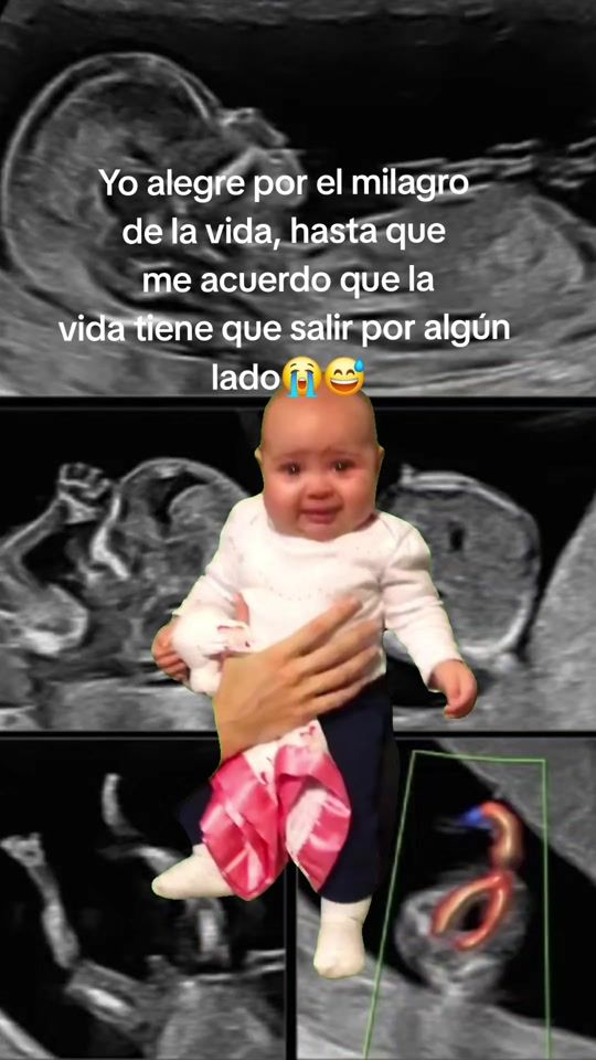 TikTok video thumbnail by maglioneclinic