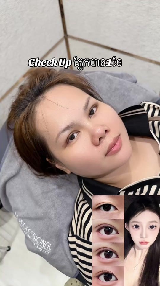 TikTok video thumbnail by yingly.dr