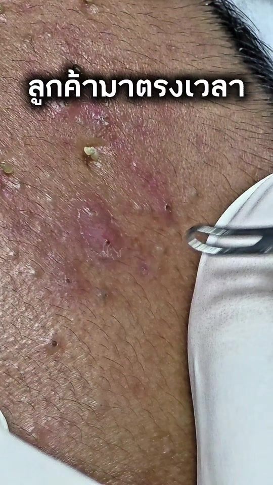TikTok video thumbnail by monallday2888