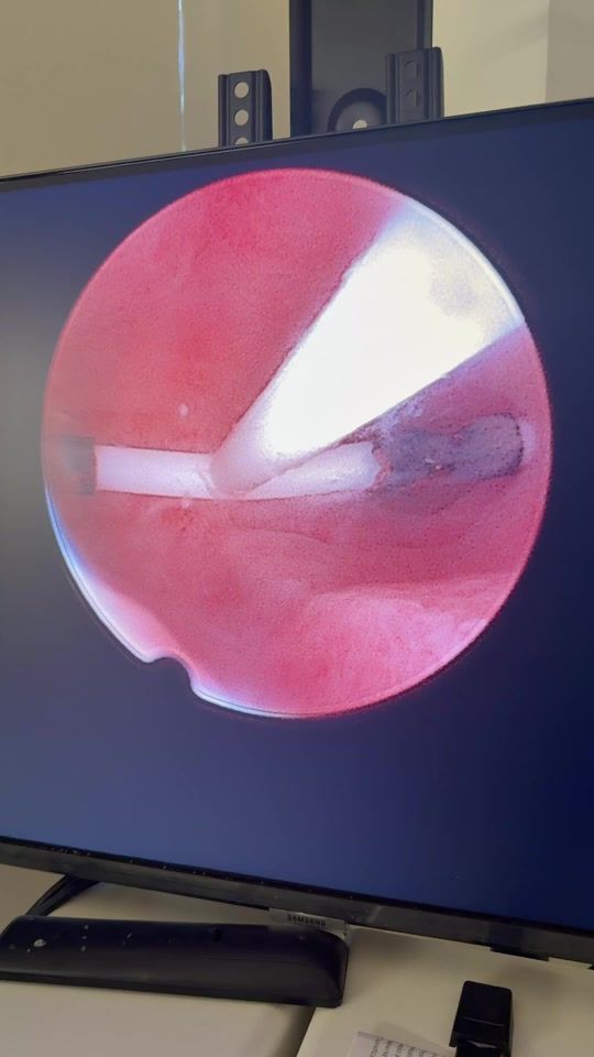 TikTok video thumbnail by dr.jonathanvera