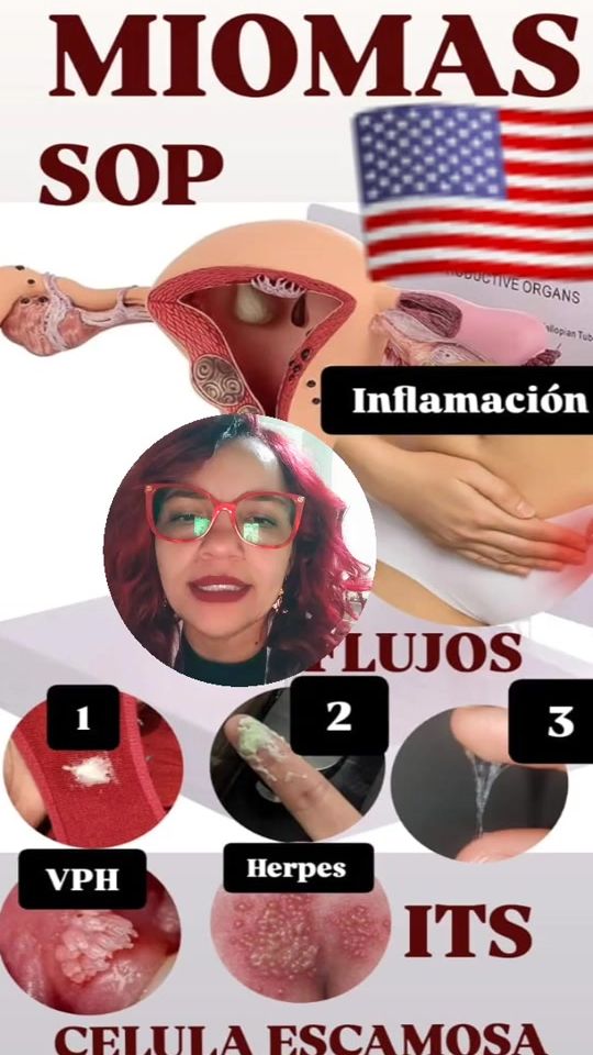 TikTok video thumbnail by nutrisionsuplermentos