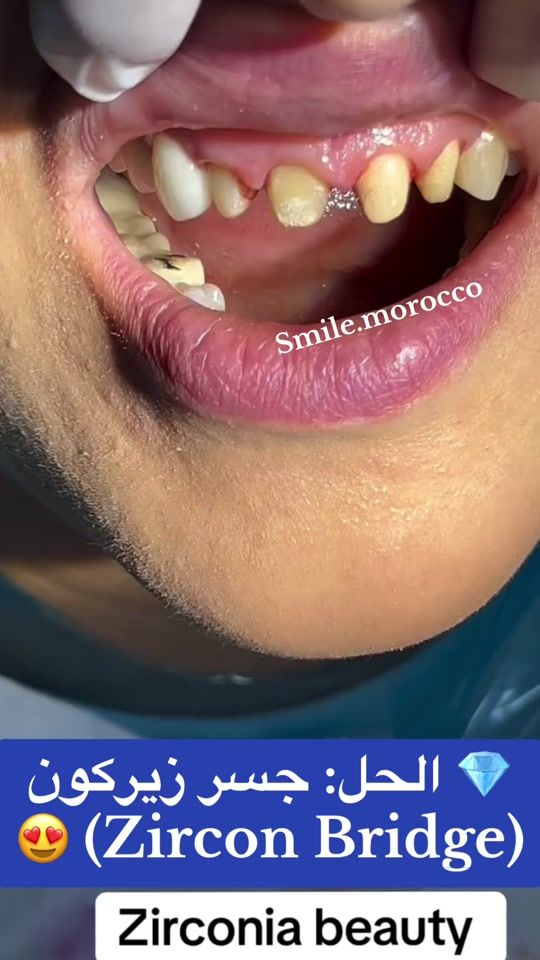 TikTok video thumbnail by smile.morocco4