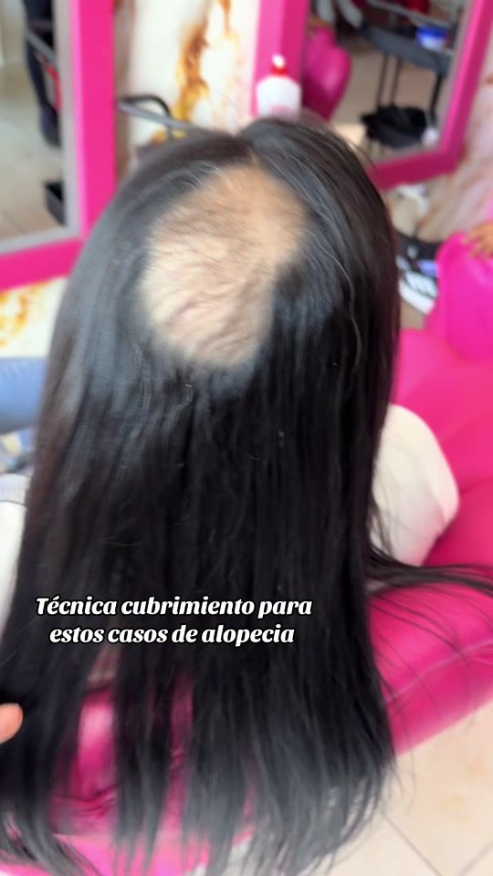 TikTok video thumbnail by trenzaslachama