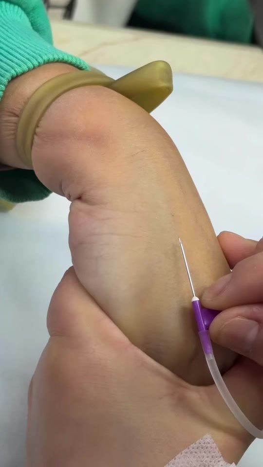 TikTok video thumbnail by dr.qiu5