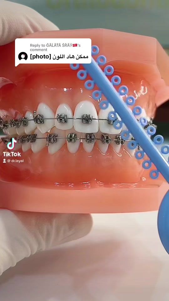 TikTok video thumbnail by dr.layal