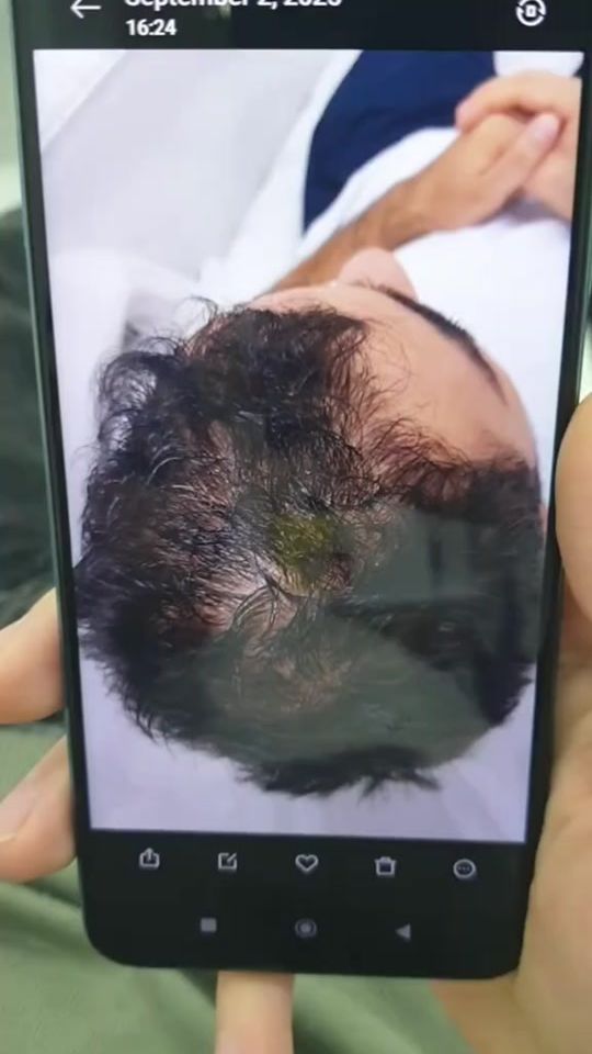 TikTok video thumbnail by _dr_aga