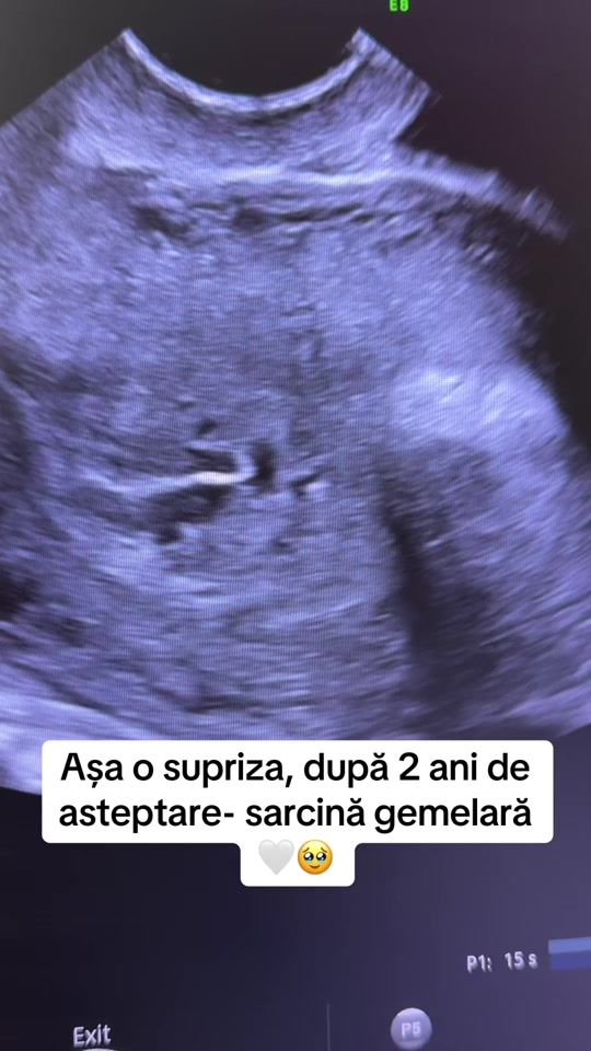 TikTok video thumbnail by dr.alina.savin