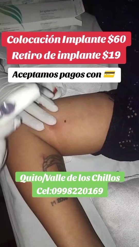 TikTok video thumbnail by medifisio