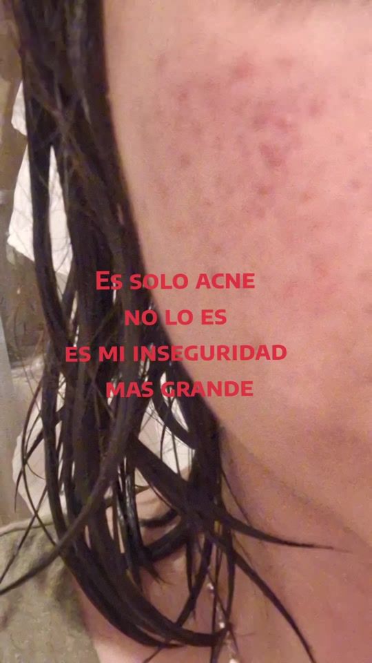 TikTok video thumbnail by ela_yla