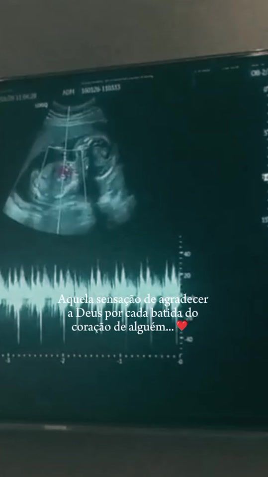 TikTok video thumbnail by douglasmendes053