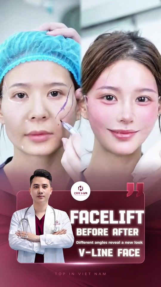 TikTok video thumbnail by dr.ha856