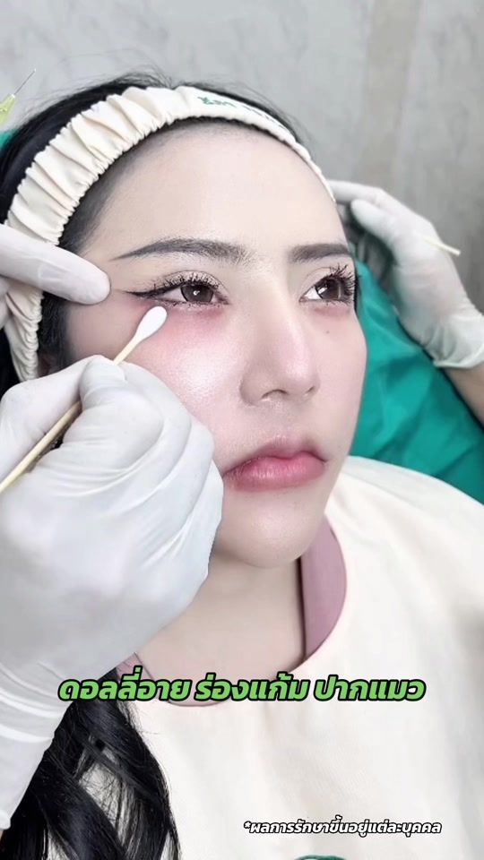 TikTok video thumbnail by rheaclinic