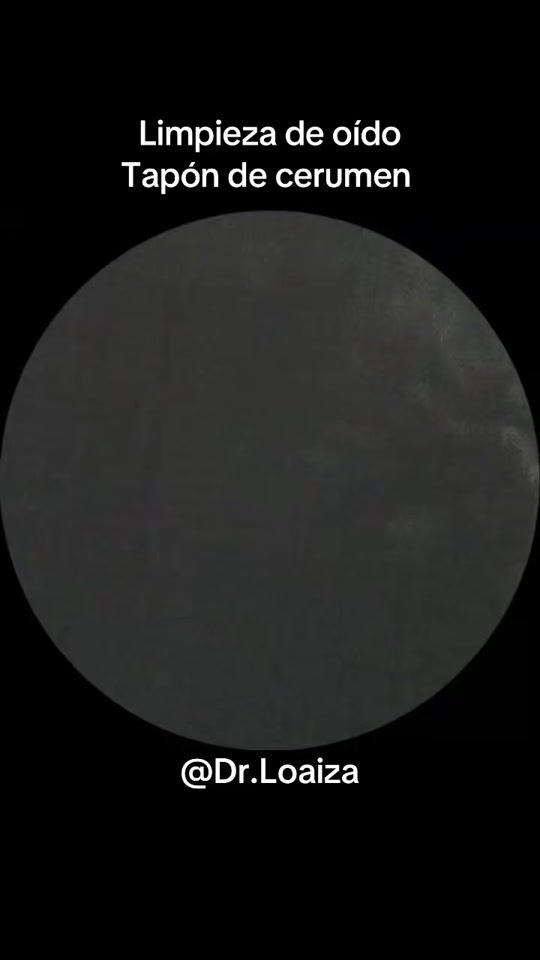 TikTok video thumbnail by dr.loaiza