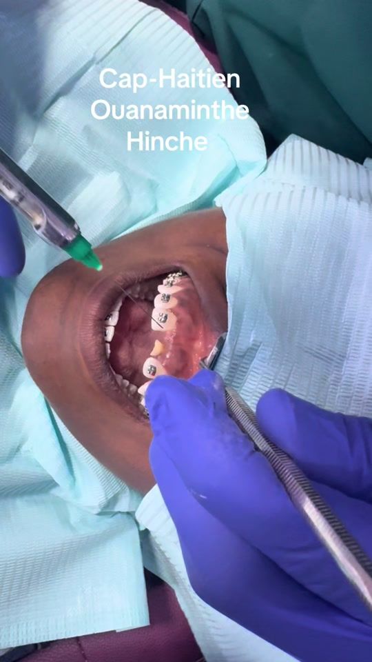 TikTok video thumbnail by 15npolyclinic