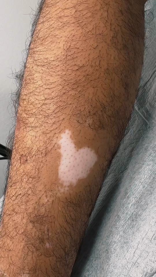 TikTok video thumbnail by kamuflaj_mesume