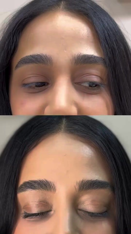 TikTok video thumbnail by dr.parvanarzayeva
