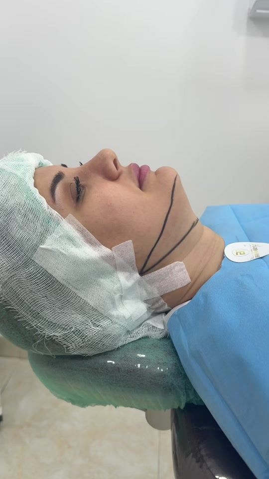 TikTok video thumbnail by dr.ibrahimbeyli