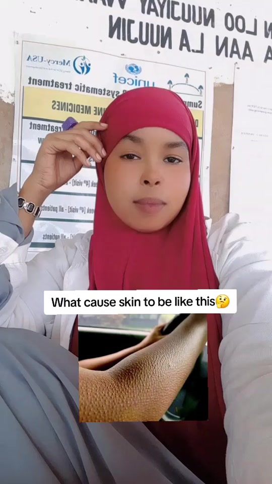TikTok video thumbnail by drs_iqro