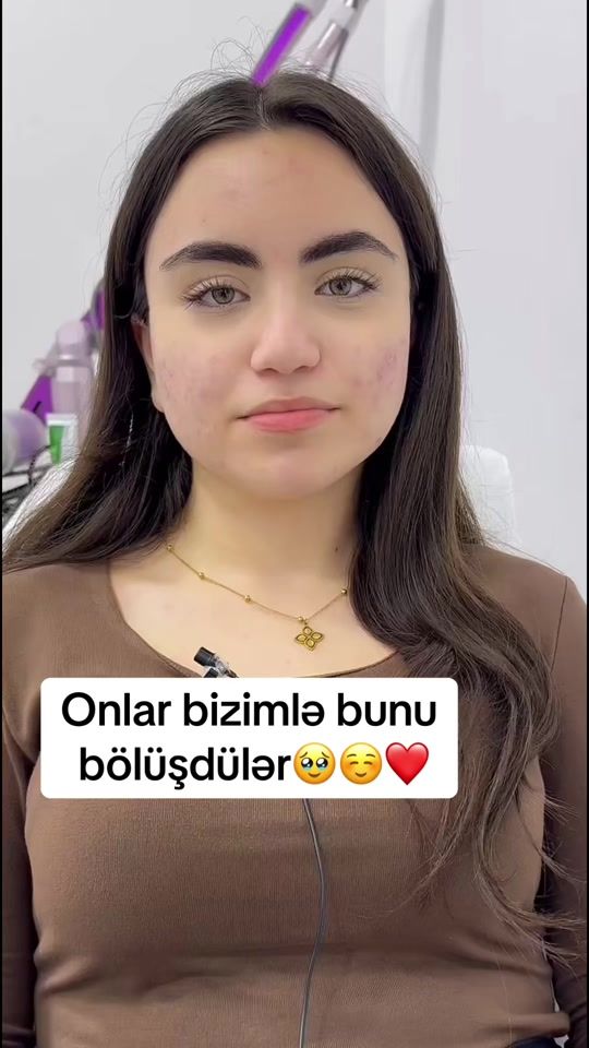 TikTok video thumbnail by dermatoloq_feride