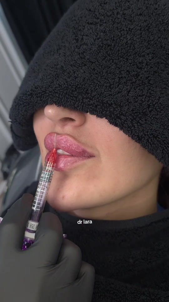TikTok video thumbnail by dr.laracheaito