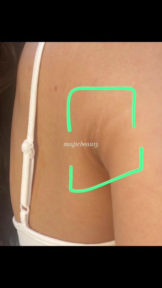 TikTok video thumbnail by magicbeauty77