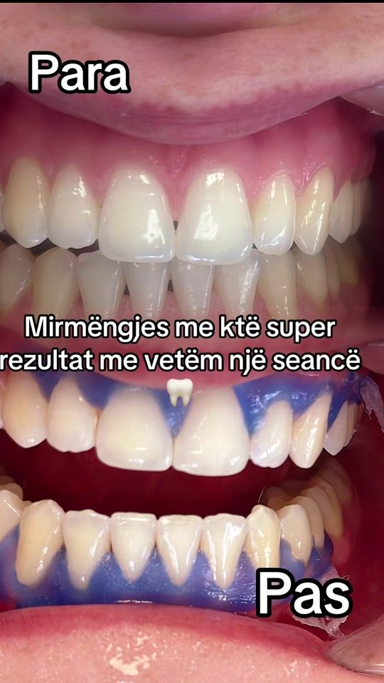 TikTok video thumbnail by drsuadameta