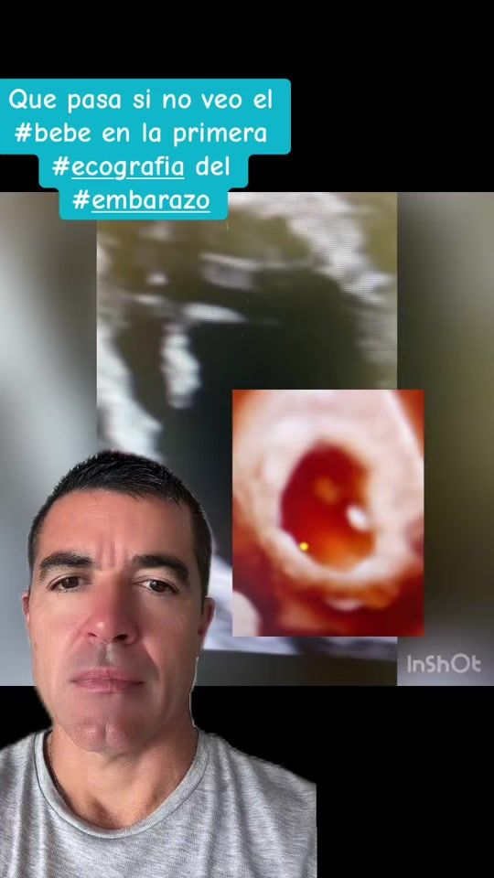 TikTok video thumbnail by docmartinolivera