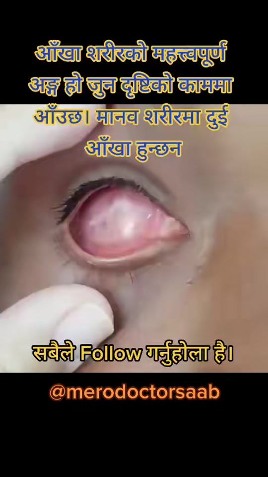 TikTok video thumbnail by merodoctorsaab