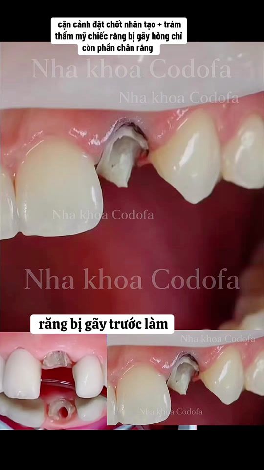 TikTok video thumbnail by nhakhoa_codofa
