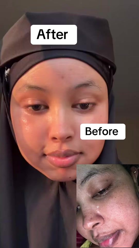 TikTok video thumbnail by nasriiincosma
