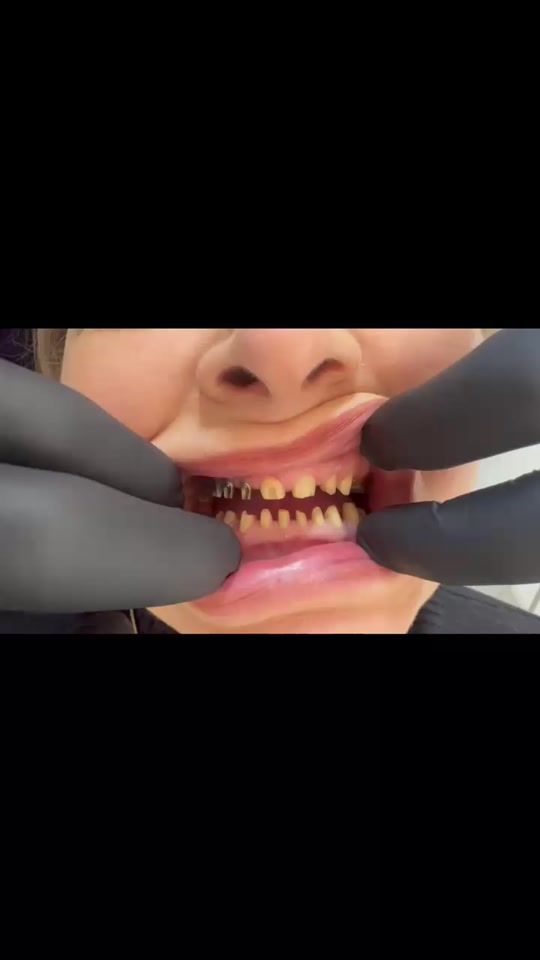 TikTok video thumbnail by dr.ruslan