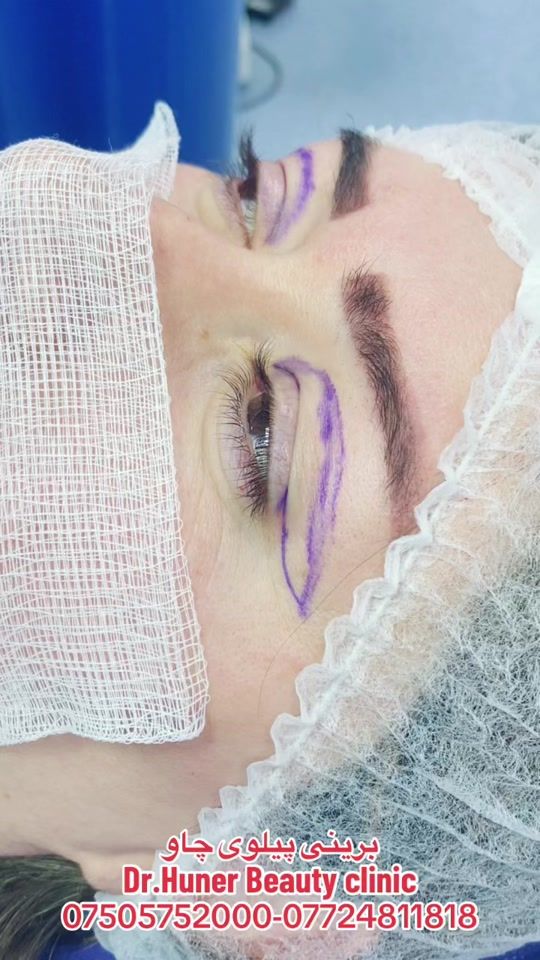 TikTok video thumbnail by dr.huner.beauty.clinic