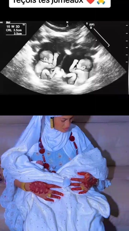 TikTok video thumbnail by docteur.agougou