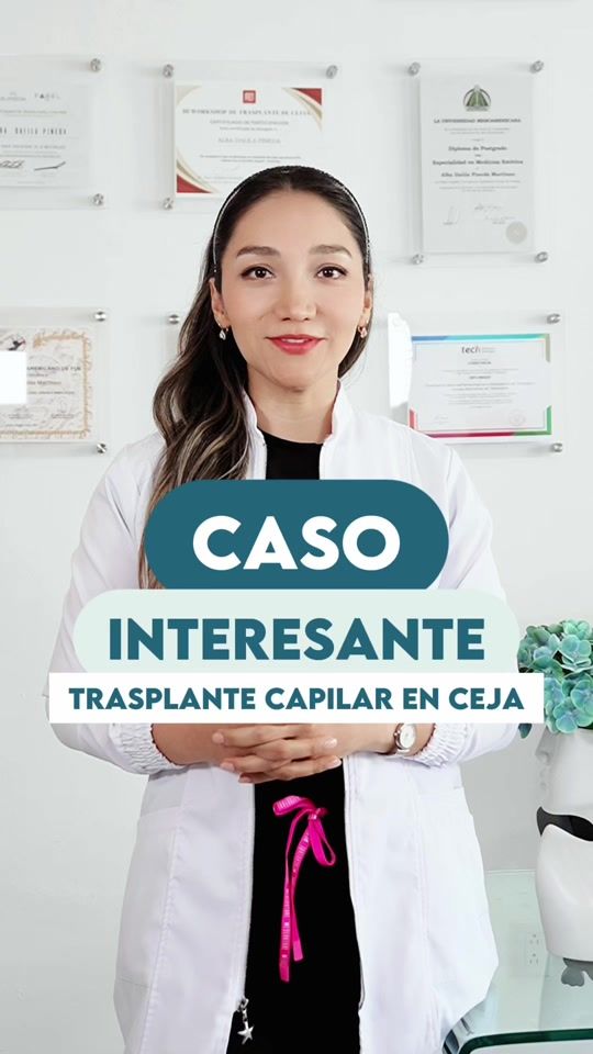 TikTok video thumbnail by capilartgt