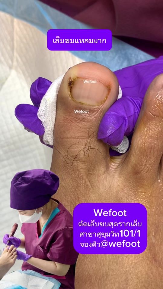 TikTok video thumbnail by wefoot8