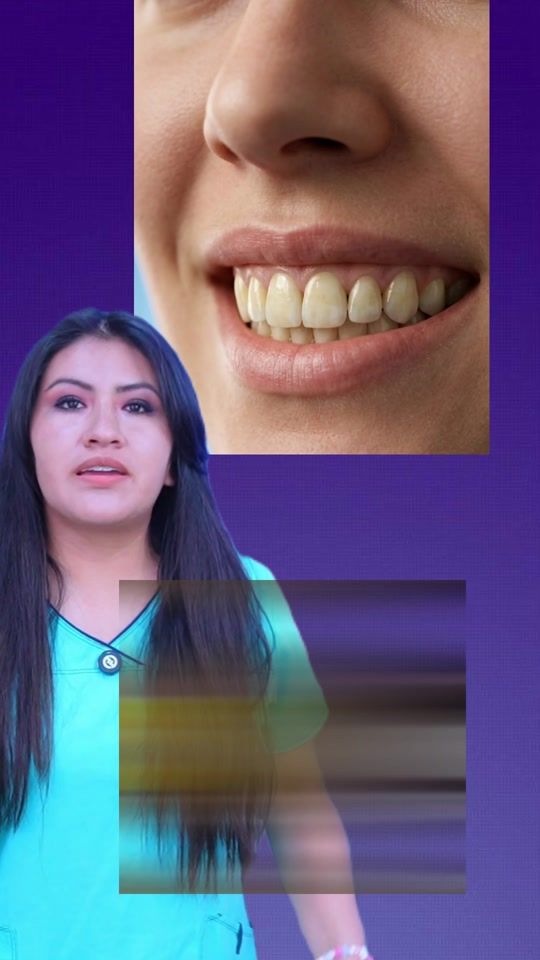 TikTok video thumbnail by drapaodentista