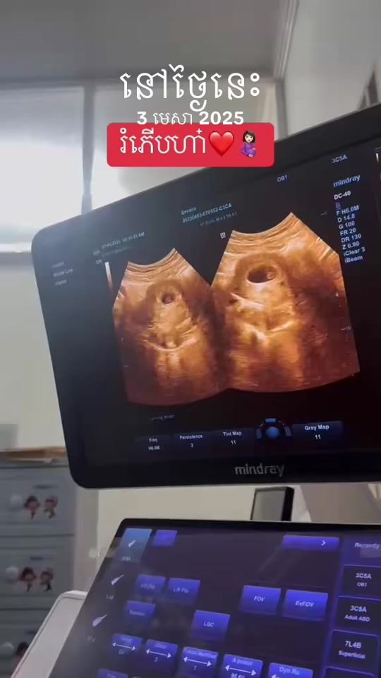 TikTok video thumbnail by savna557
