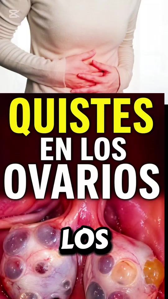 TikTok video thumbnail by nutrisionsuplermentos