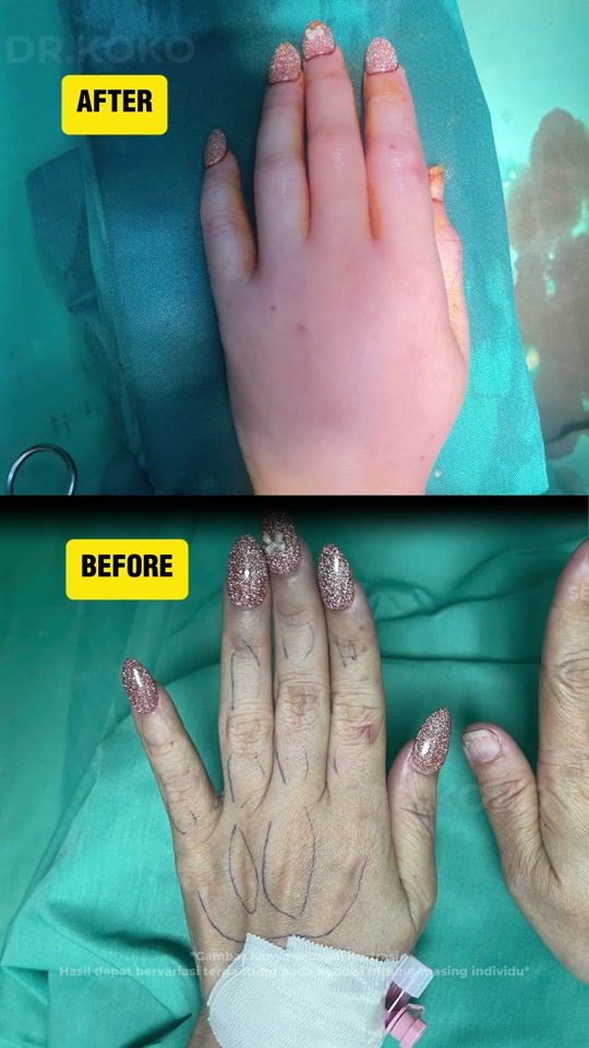 TikTok video thumbnail by dr.kokomd