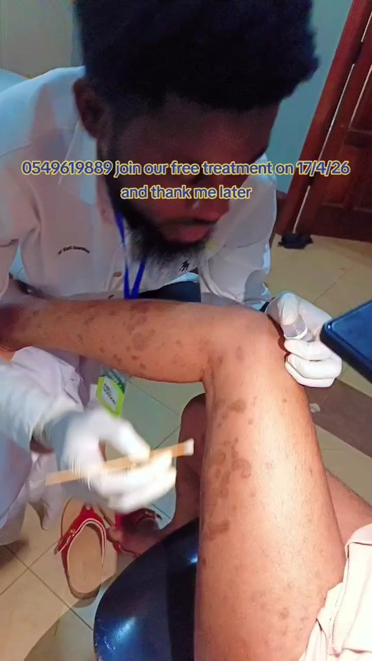 TikTok video thumbnail by dr.nao1