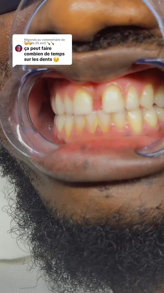 TikTok video thumbnail by lorenanupcie
