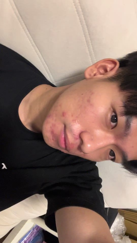 TikTok video thumbnail by youngpig216