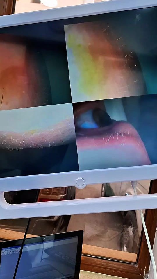 TikTok video thumbnail by _dr_aga