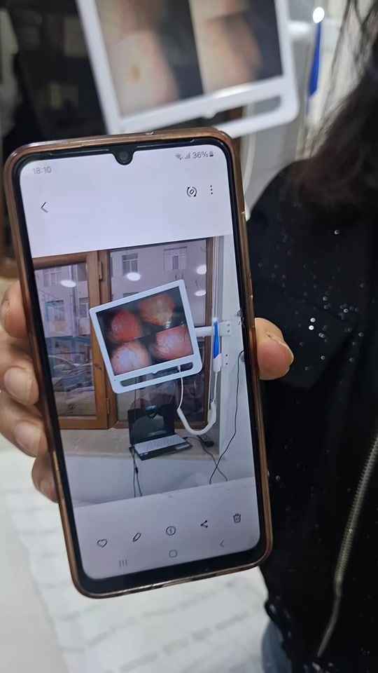 TikTok video thumbnail by _dr_aga