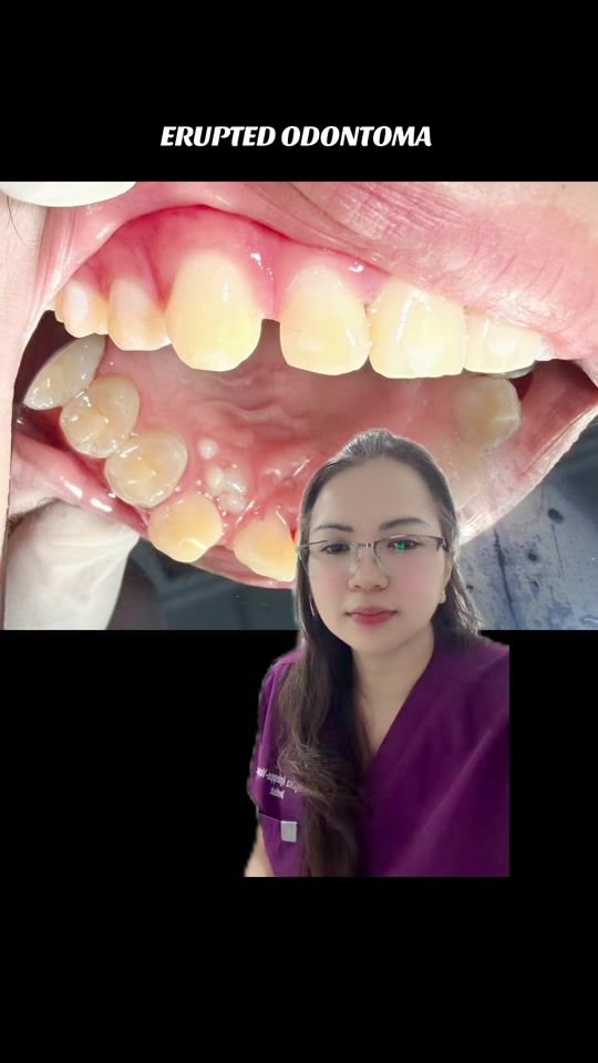 TikTok video thumbnail by doc_jhing