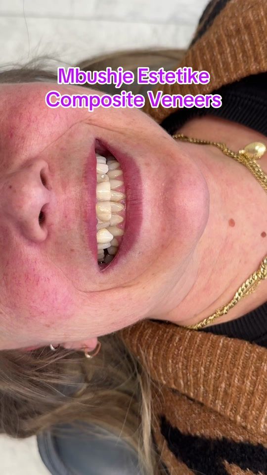 TikTok video thumbnail by dr.lekegrezda