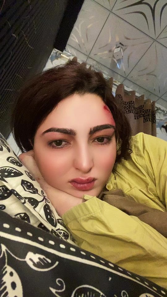 TikTok video thumbnail by sweetypeshawar1