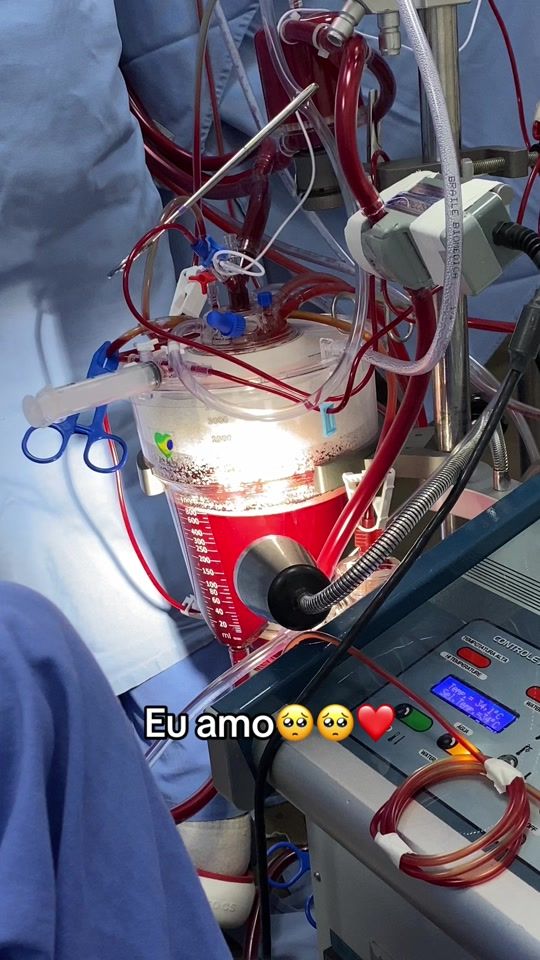 TikTok video thumbnail by bruno.perfusao