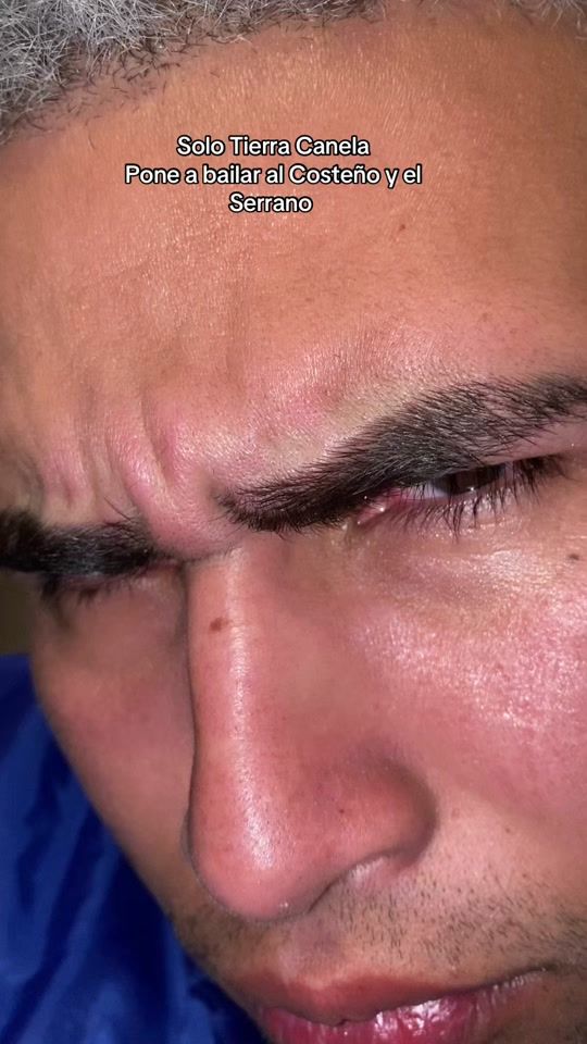 TikTok video thumbnail by cejitas.bj